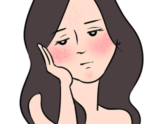 酒さの悩み